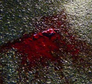 Житель Смоленска нашел истекающего кровью гражданина