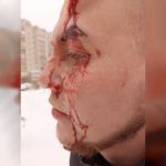 В Смоленске неизвестные избили молодого парня