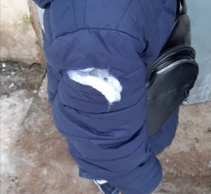 В Смоленской области брошенный пёс напал на детей